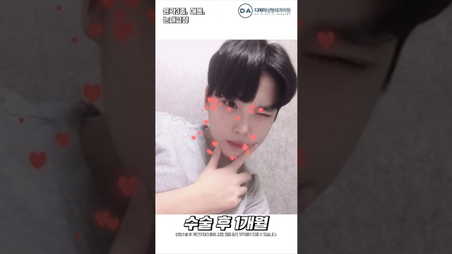윤곽3종+매몰+눈매교정 #Shorts