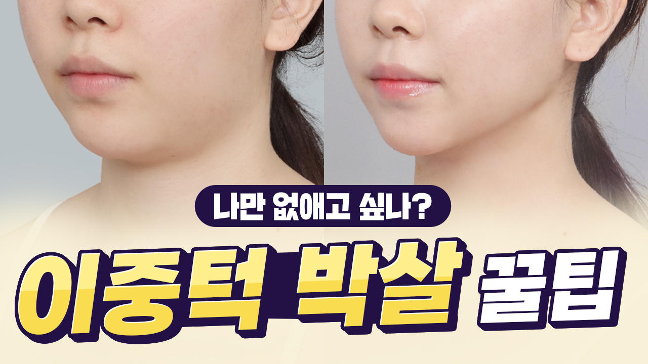 이중턱 박살내는 리프팅 꿀팁