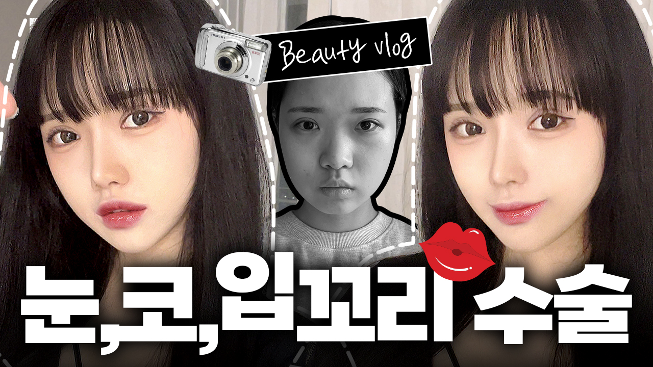 눈,코,입꼬리 수술 브이로그