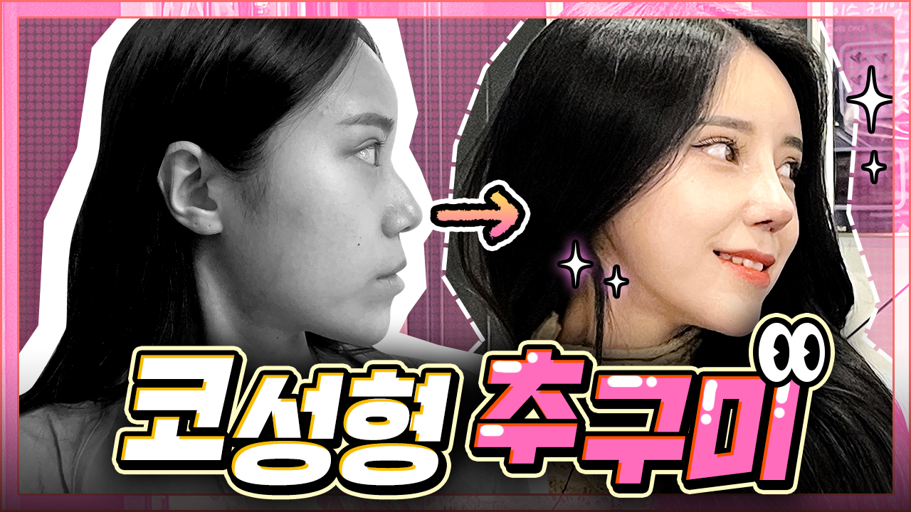 코성형 브이로그